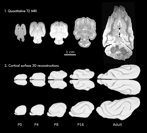 Using neuroimaging genomics to investigate the evolution of human brain  structure